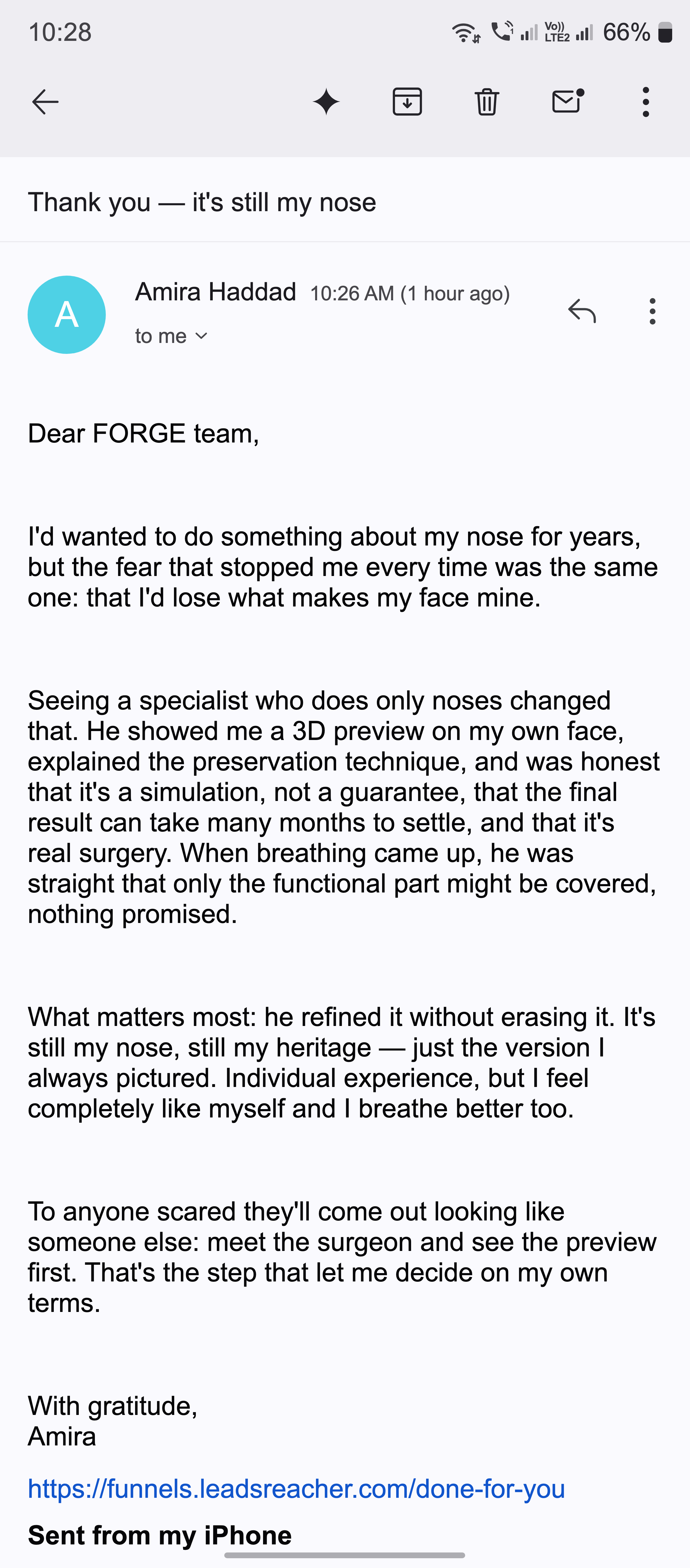 A thank-you email about a nose that was refined but still looks like their own